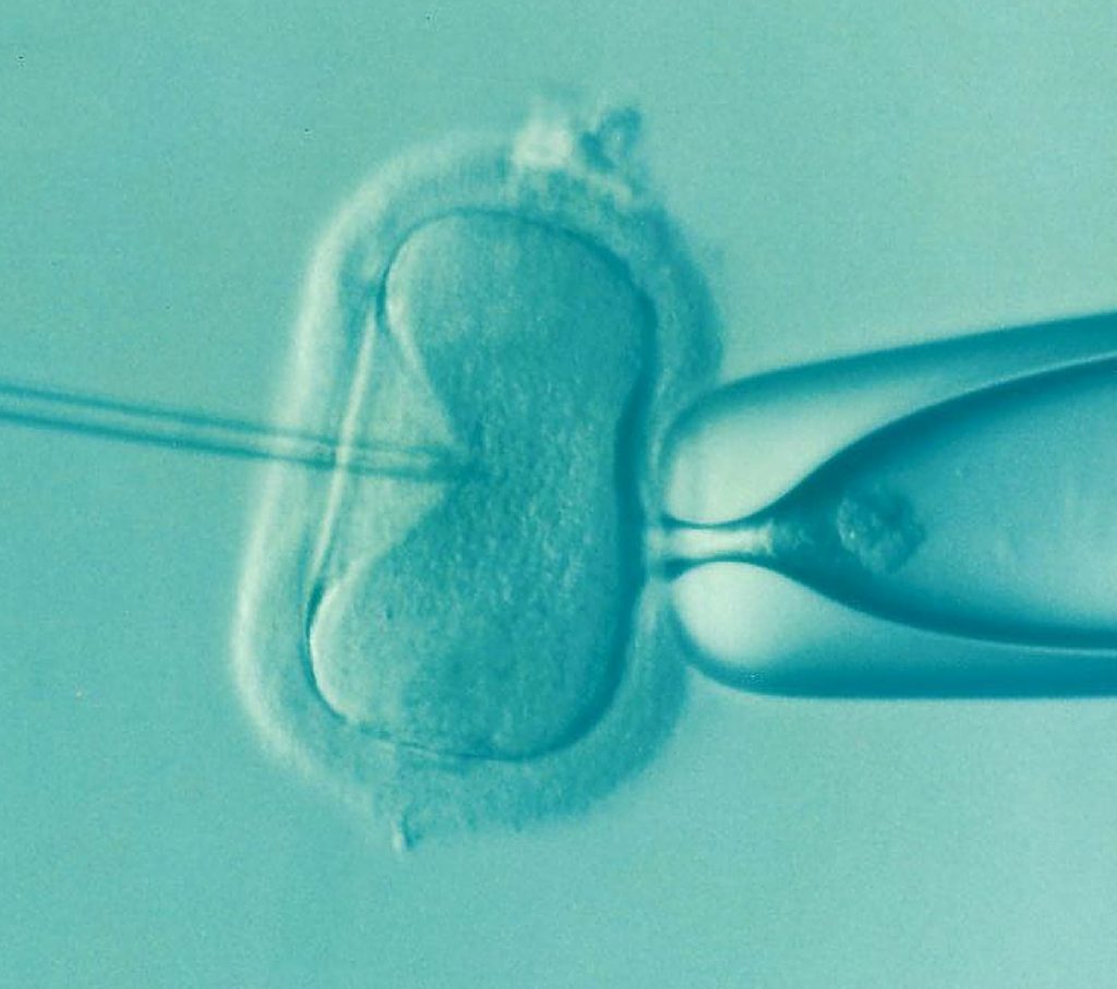 IVF baby conception prengany struggle sydney